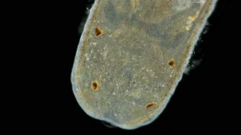Nemertea worm under a microscope, class Hoplonemertea, order Monostilifera. Stock Footage 232651600
