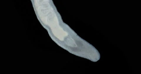 Nemertea worm under a microscope, class Hoplonemertea, order Monostilifera Stock Footage 232987859