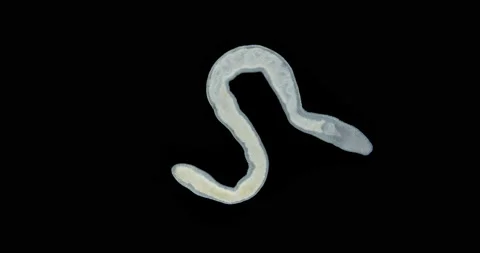 Nemertea worm under a microscope, class Hoplonemertea, order Monostilifera Stock Footage 232989356