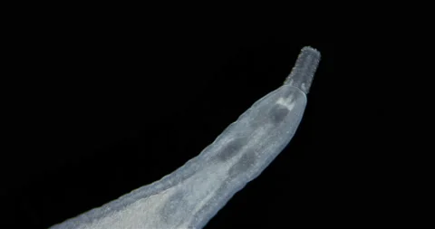 Nemertea worm under a microscope, class Hoplonemertea, order Monostilifera Stock Footage 232989713