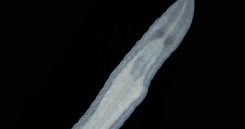 Nemertea worm under a microscope, class Hoplonemertea, order Monostilifera Stock Footage 233065909