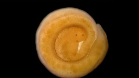 Nemertea worm under a microscope, class Hoplonemertea, order Monostilifera Stock Footage 233856190