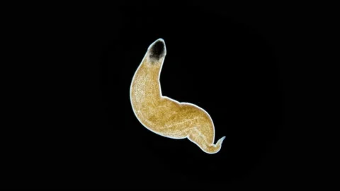 Nemertea worm under a microscope, class Hoplonemertea, possibly Hubrechtellidae Stock Footage 235716288