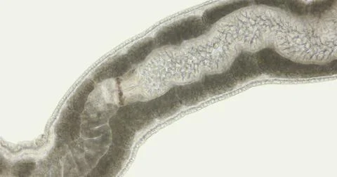 Nemertea worm under a microscope, class Hoplonemertea, order Monostilifera... Foto stock