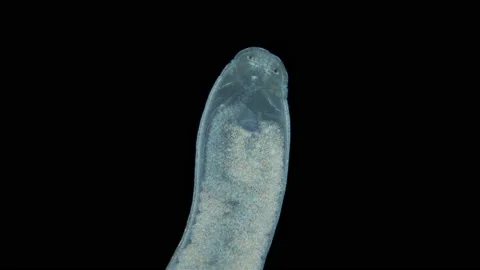 Nemertea worm under a microscope, family Tetrastemmatidae, genus Tetrastemma sp Stock Footage 167221068