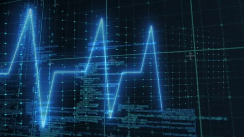 Neon-blue ECG waveform streaming across 3D grid with glowing turquoise nodes Stock Footage 307550945