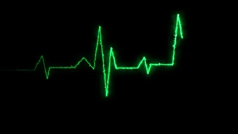 Neon Digital Heartbeat Plus Animation. Neon heartbeat on black isolated bac.. Stock Footage 260115085