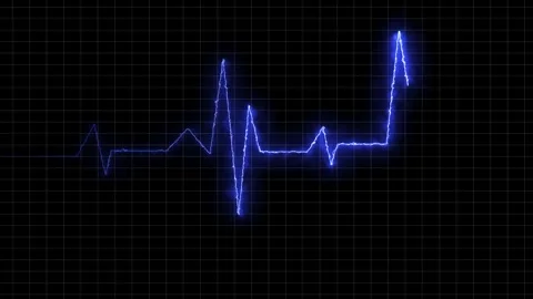 Neon Digital Heartbeat Plus Animation. Neon heartbeat on black isolated bac.. 库存影片 260115092