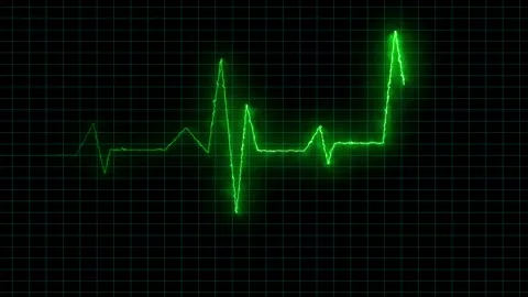Neon Digital Heartbeat Plus Animation N Stock Video Pond5