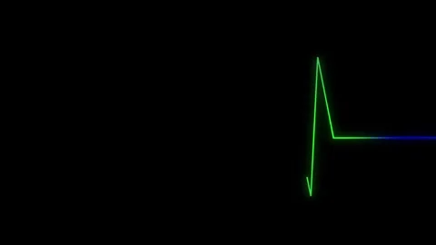 Neon green line graph animation on black. Neon green line graph abstract da.. Stock Footage 337133714