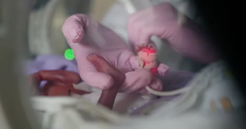 Neonatal Care A Gentle Touch of Compassion for Preterm Infants and Their Stock Footage 290840233