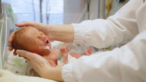 Neonatal Intensive Care Stock Footage 311815011