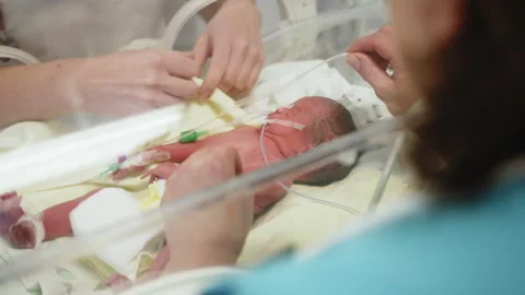 Neonatal Intensive Care Stock Footage 311815563