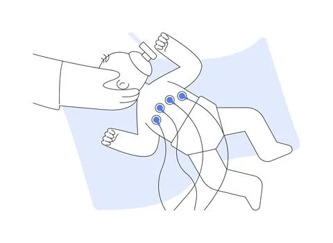 Neonatal surgery abstract concept vector illustration. Stock Illustration