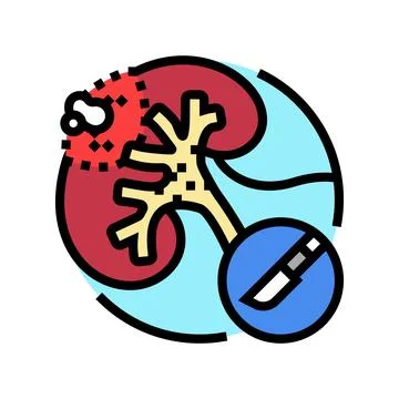Nephrectomy urology color icon vector illustration Stock Illustration