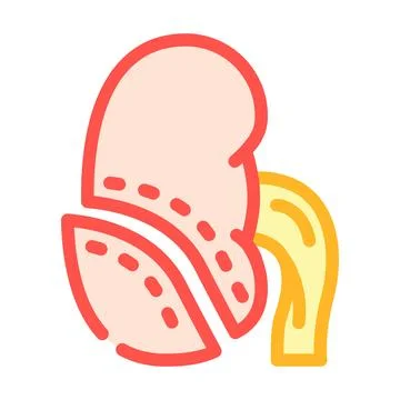 Nephrectomy urology color icon vector illustration Stock Illustration