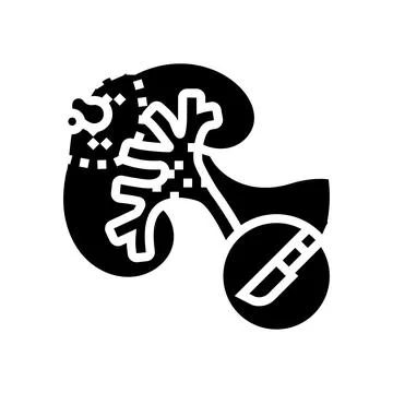 Nephrectomy urology glyph icon vector illustration Stock Illustration