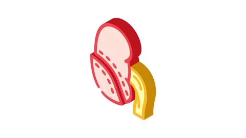 Nephrectomy urology isometric icon animation Stock Footage 327275804