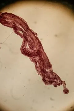Nephridium of earthworm 스톡 사진