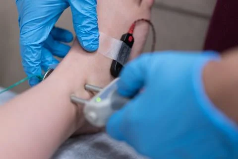 Nerve Conduction Testing Stock Photos