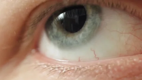 Nervous blinking, close-up eye.Full hd video Stock Footage 160720457