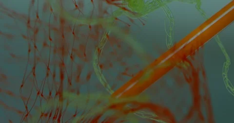 Netting Causing Environmental Damage To Beautiful Oceans With Other Plastic Stock Footage 113382201