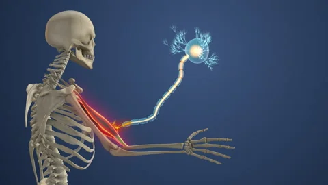 Neurological Disorder Causing Skeletal Muscle Weakness Stock Footage 325835628