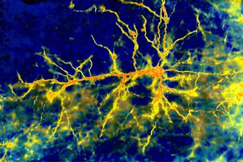  Neuron Optical Microscope. Magnification: 600x. Copyright: xCAVALLINIxJAM... Stock Photos