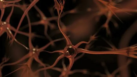 Neurons With Amyloid Plaques, Stock Photos