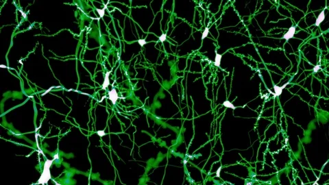 Neurons marked by fluorescence Stock Footage 75603450