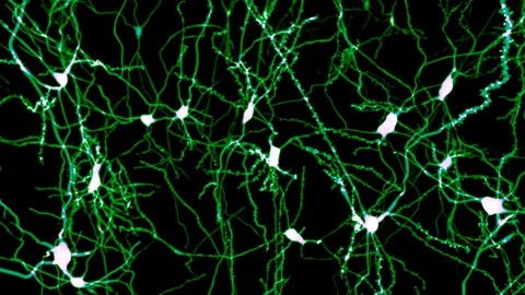 Neurons marked by fluorescence Stock Footage 242610105