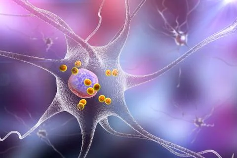 Neurons in Parkinson's disease Stock Photos