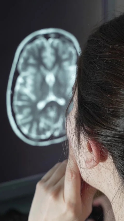 Neuroradiologist Analyzing Brain MRI Stock Footage 277119381