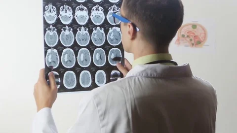 A neurosurgeon doctor looks at a Magnetic resonance imaging MRI snapshot of the Stock Footage