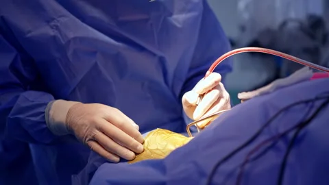 Neurosurgeon performing delicate brain surgery.  Stock Footage 317443463