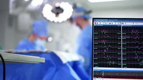  Neurosurgeons in brain surgery operation room.  스톡 동영상 316969543