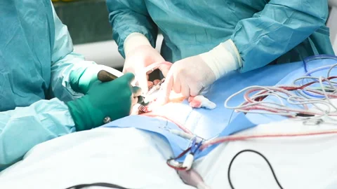 Neurosurgeons perform surgery to excise a brain tumor Stock-Footage 104410204