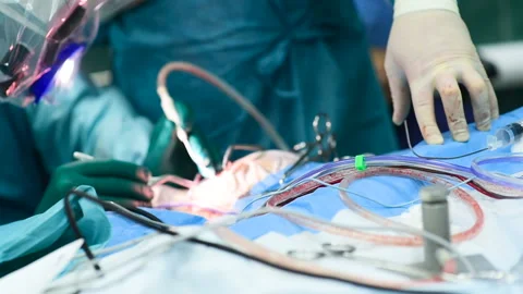 Neurosurgeons perform surgery to excise a brain tumor Stock-Footage 104410663