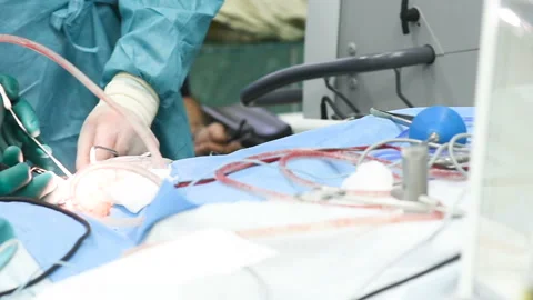 Neurosurgeons perform surgery to excise a brain tumor Stock-Footage 104411122