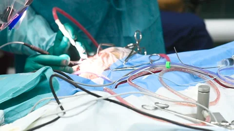 Neurosurgeons perform surgery to excise a brain tumor Stock-Footage 139163034