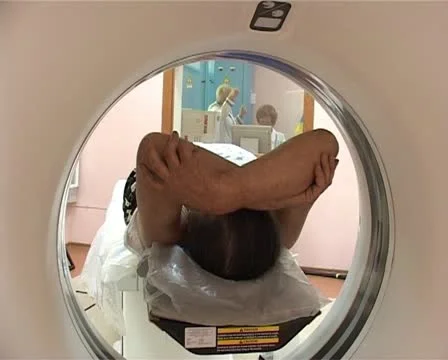 Neurosurgical Stock-Footage 12289415