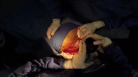 New Born birth Stock Footage 53301392