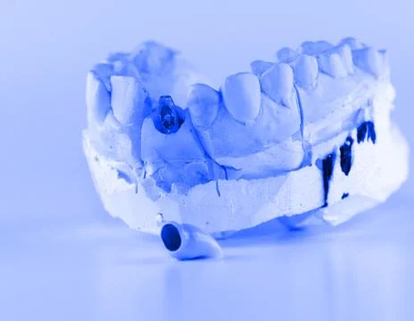 New dentures on a white background Stock Photos