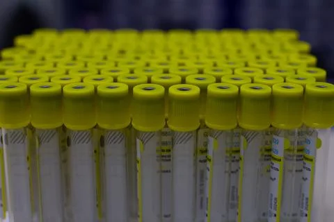 A new pack of test tubes is on the table in the laboratory. The tubes are ready Stock Photos