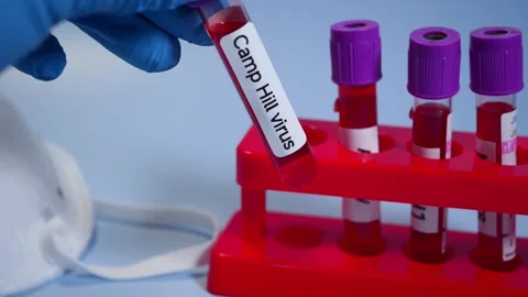 A new pathogen, called Camp Hill virus, was recently discovered in Alabama Stock Footage 303210489