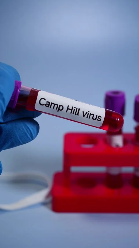 A new pathogen, called Camp Hill virus, was recently discovered in Alabama Stock-Footage 303212545