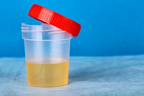 New Plastic container with urine analysis Stock Photos