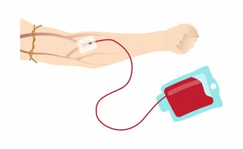 A new sterile needle is inserted into a vein in arm Stock Illustration