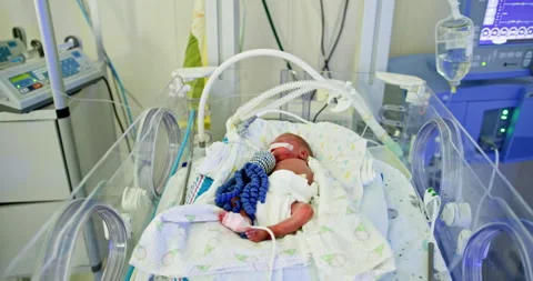 Newborn Care and Comprehensive Management within the Neonatal Intensive Care Stock Footage 290797862