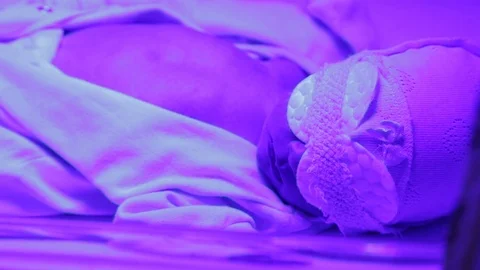 Newborn under ultraviolet lamp Stock Footage 103174248